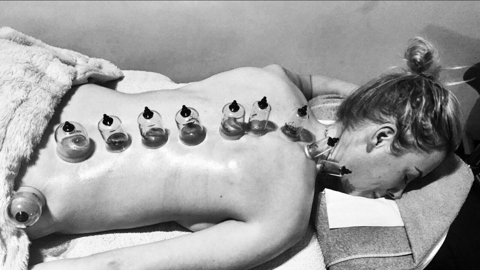 cupping, massage trend